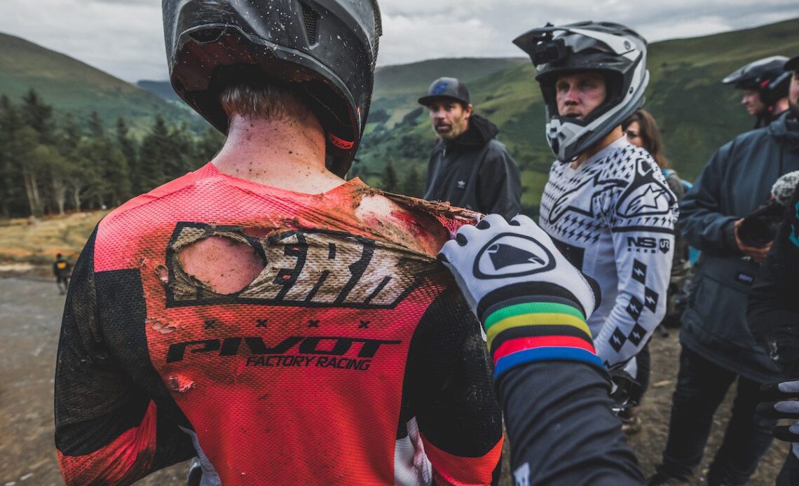 Bernard Kerr shows off cuts from a big crash at Red Bull Hardline