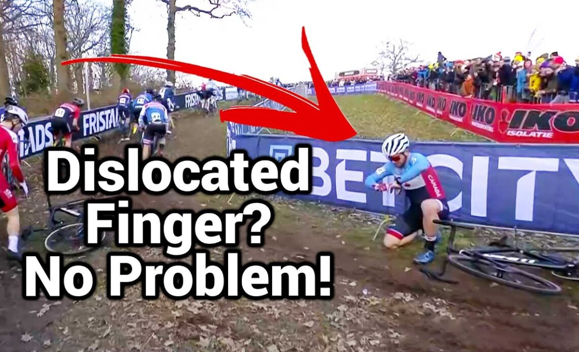 Canadian Snaps Finger Back To Continue Cyclocross World Championships