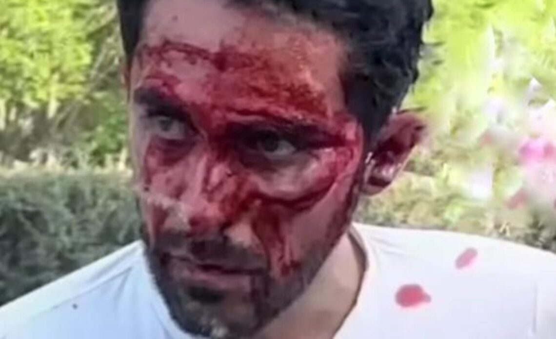 Alberto Contador crashes in China and smashes face