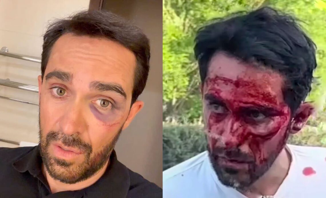 Alberto Contador gets multiple facial stitches after Vuelta España event crash in China