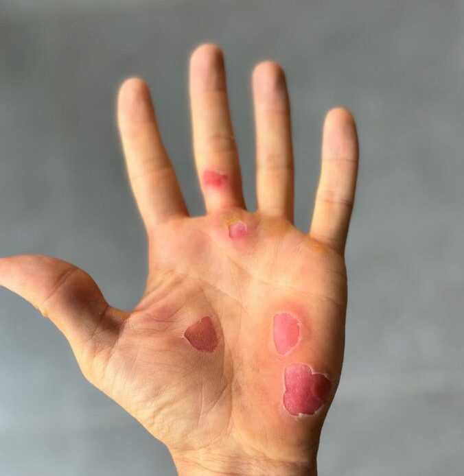So many riders have mangled hands after Roubaix...except one: Guess who?